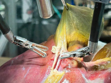 Doktorlara kötü haber: Bir robot, insan gibi ameliyat yapmayı başardı!