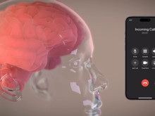 Düşünceleriniz yazıya dönüşebilir mi? Neuralink’in yeni klinik çalışması