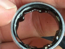 Samsung Galaxy Ring parmağında şişti, macera hastanede sona erdi