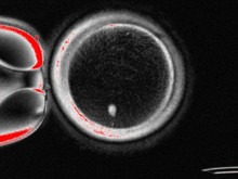 Bilim insanları deri hücresinden yumurta üretmeyi başardı