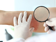 Ciltte görülen basit bir döküntü, bize çok şey anlatıyor olabilir