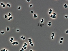 Ölü taklidi yapan süper bakteriler, uzayı bile tehdit ediyor