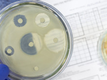 2035 uyarısı geldi: Antibiyotikler etkisini yitiriyor