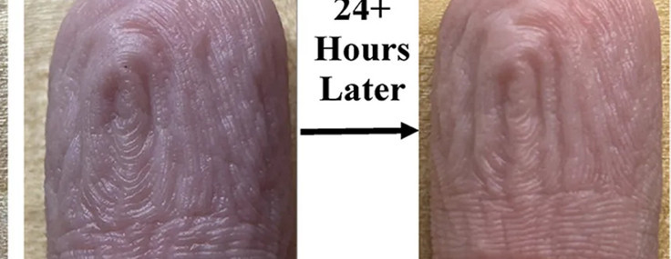 Her defasında aynı desen: Parmaklardaki kırışıklıklar hakkında şaşırtıcı keşif