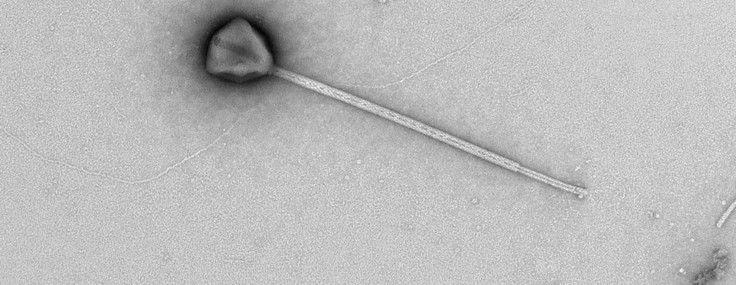 Sıra dışı bir “dev virüs” keşfedildi: Kuyruğu rekor uzunlukta!