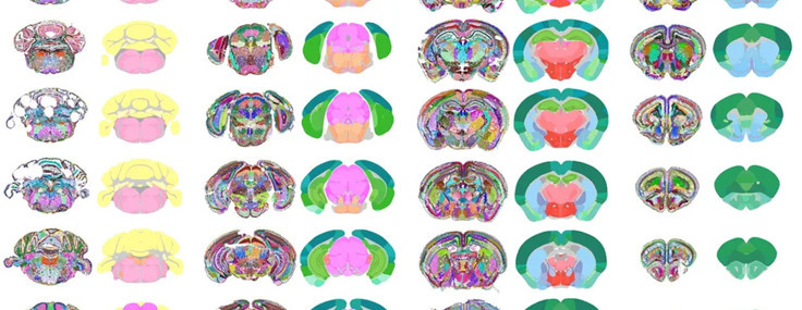 Yapay zeka, beyindeki sır perdesini de kaldırıyor