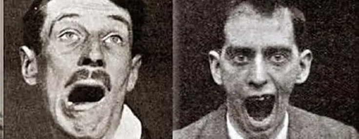 Tarihin en gizemli hastalığı: Yarım milyon insanı öldürdü, bir anda ortadan kayboldu