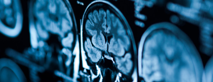 Zihnindeki sesler hayatını kurtardı: Tıp tarihinin en gizemli teşhis hikayesi