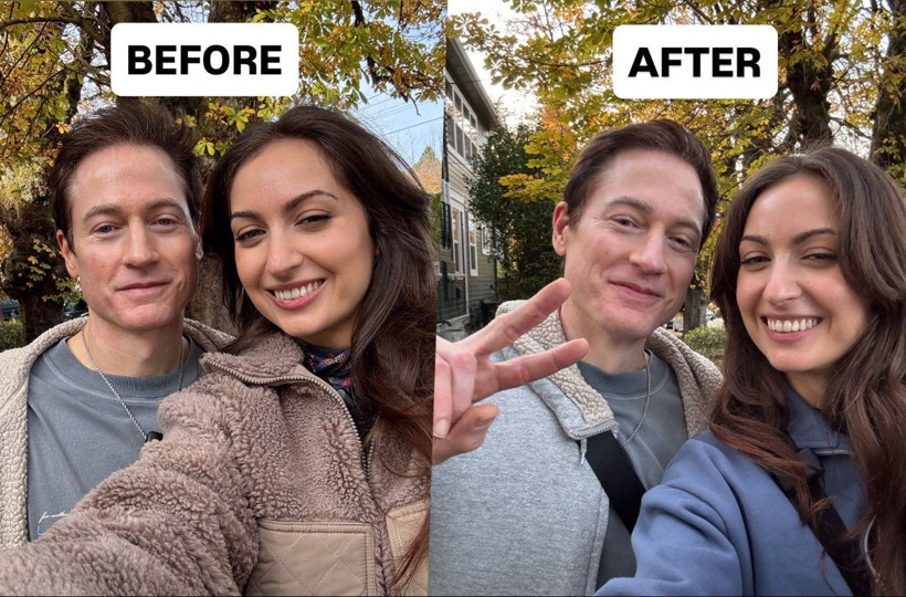 18 yaşına dönmek için yılda 2 milyon dolar harcıyordu: Son durumu ne? - Resim: 3