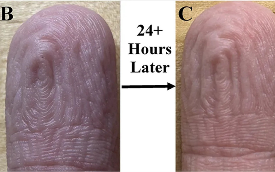 Her defasında aynı desen: Parmaklardaki kırışıklıklar hakkında şaşırtıcı keşif