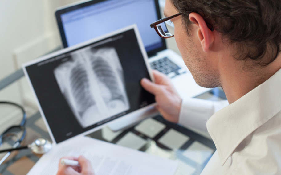 Milyonlarca kanser vakanın arkasındaki şaşırtıcı gerçek