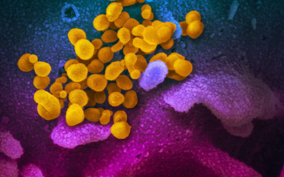 COVID-19'un beyindeki "sessiz" izi: Siz iyileştiğinizi sanıyorsunuz ama...