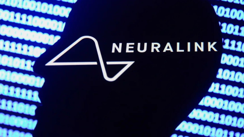 Elon Musk'ın beyin çiplerine onay çıkmadı