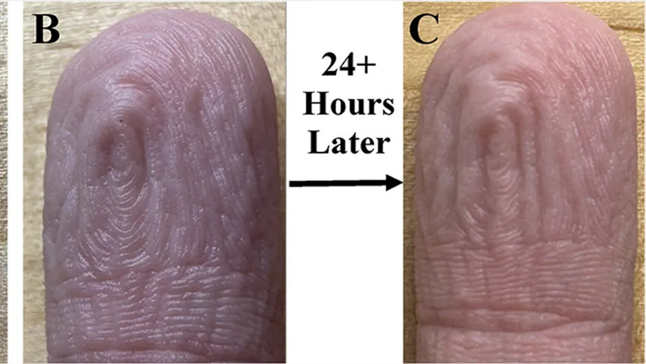 Her defasında aynı desen: Parmaklardaki kırışıklıklar hakkında şaşırtıcı keşif