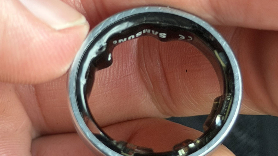 Samsung Galaxy Ring parmağında şişti, macera hastanede sona erdi