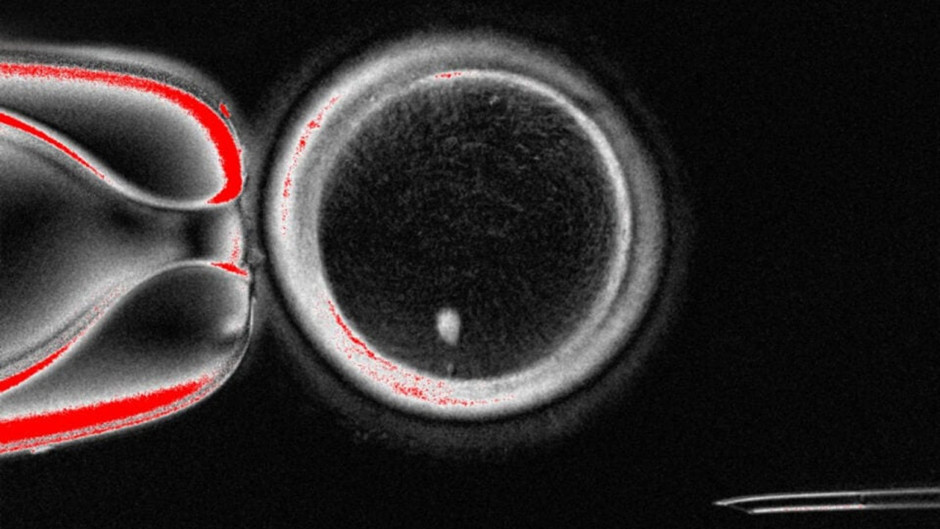 Bilim insanları deri hücresinden yumurta üretmeyi başardı