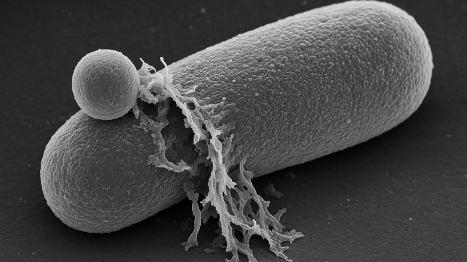 Antibiyotiklerin bakterileri öldürmesi gerçek zamanlı görüntülendi?