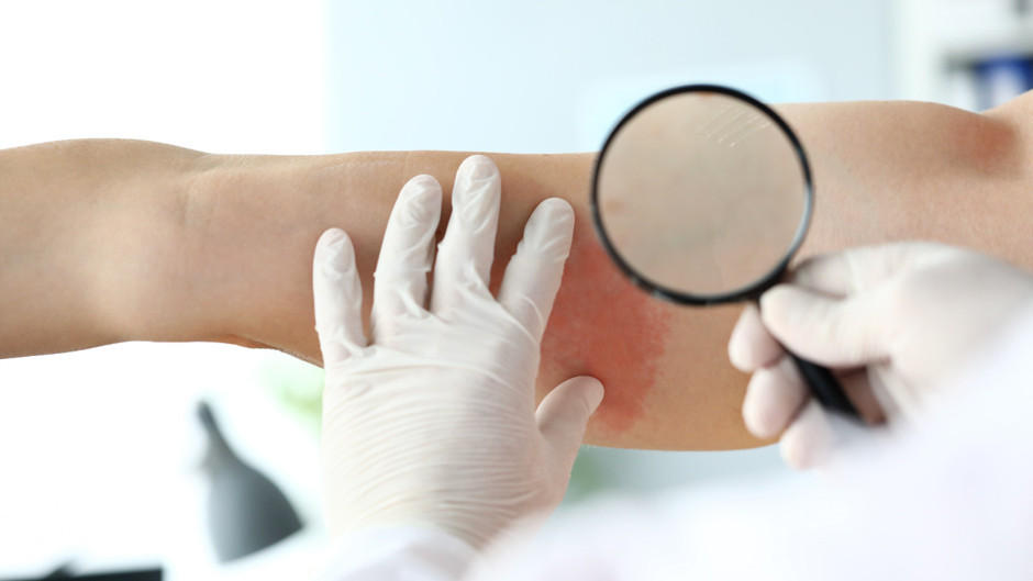 Ciltte görülen basit bir döküntü, bize çok şey anlatıyor olabilir